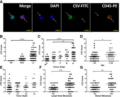 Evaluation of Cell Surface Vimentin Positive Circulating Tumor Cells as a Diagnostic Biomarker for Lung Cancer
